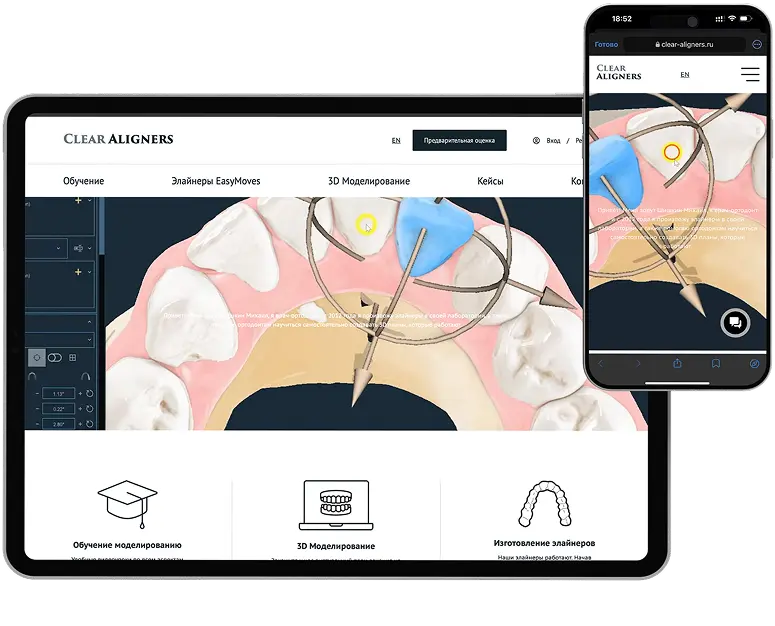 Сайт для производителя элайнеров